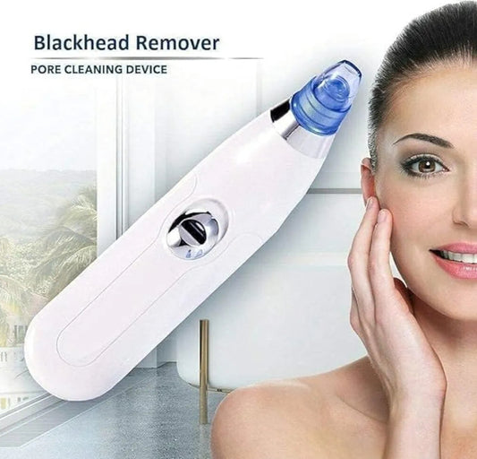 🧖‍♀️ Electric Blackhead Remover & Pore Vacuum Cleaner ✨