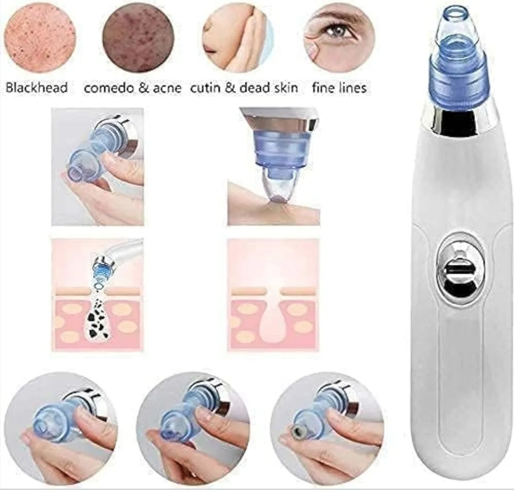 🧖‍♀️ Electric Blackhead Remover & Pore Vacuum Cleaner ✨