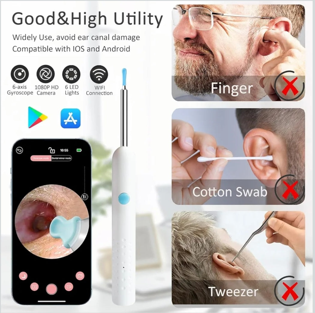 🧠 Smart Visual Ear Cleaner – 1080P HD Otoscope with 6 LED Lights