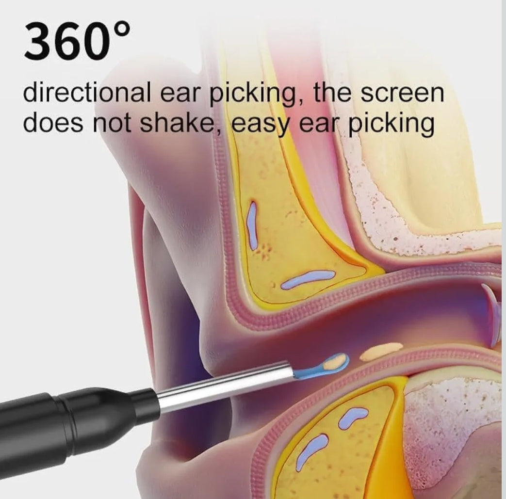 🧠 Smart Visual Ear Cleaner – 1080P HD Otoscope with 6 LED Lights