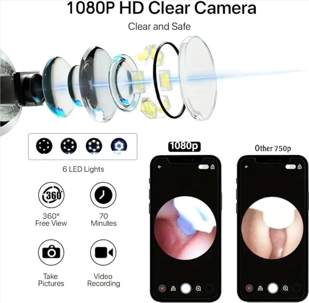 🧠 Smart Visual Ear Cleaner – 1080P HD Otoscope with 6 LED Lights